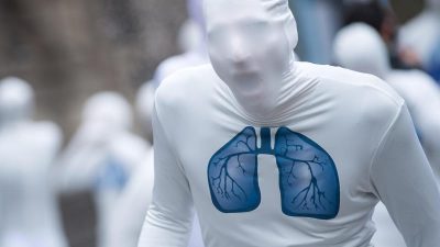 Lungenarzt: Stickstoffausstoß um europäischen Grenzwert „total ungefährlich“ – Fahrverbote nicht notwendig