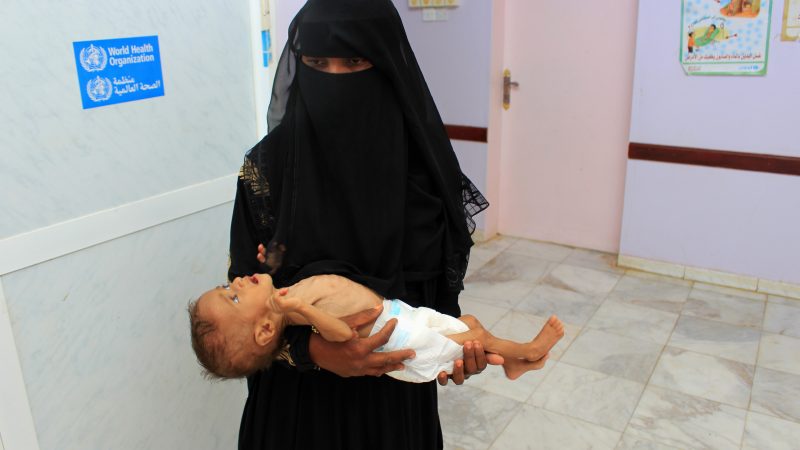 Hilfsorganisation: 85.000 Kinder im Jemen an Hunger und Krankheit gestorben