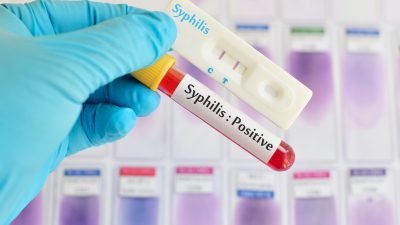 Offenbarungseid für „Sexuelle Revolution“ und staatliche „Aufklärung“: Syphilis seit Jahren auf dem Vormarsch