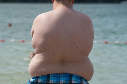 Er rettet sich selbst das Leben: Rügener nimmt 150 kg ab und will andere inspirieren