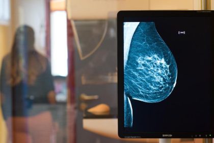 Rückgang bei im Krankenhaus behandelten Brustkrebs-Fällen