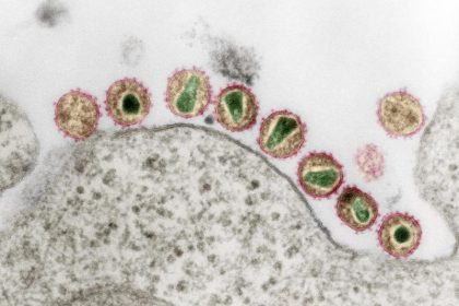 „Düsseldorfer Patient“ womöglich von HIV geheilt