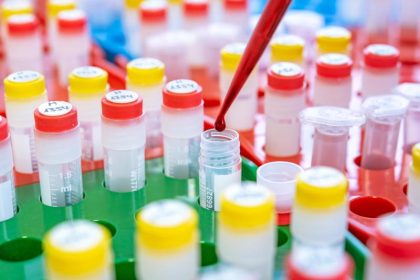 Down-Syndrom: Bei den Trisomie-Tests geht es um ethisch grundsätzliche Fragen