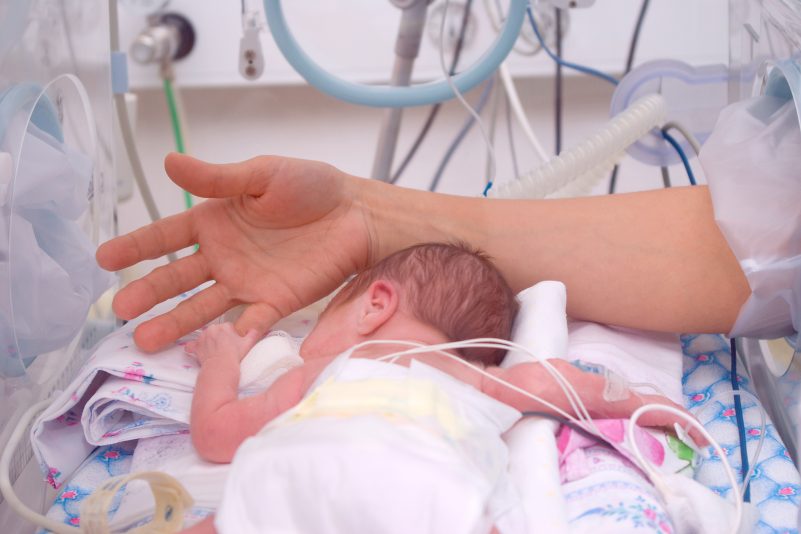 Komplizierte Geburt: Corona-Patientin im Koma bringt Kind zur Welt