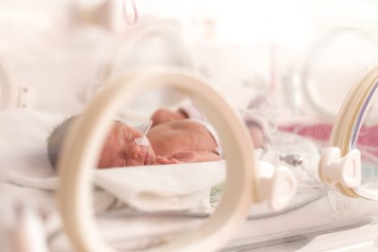 Nur so groß wie ein Apfel – Leichtestes Baby der Welt darf Krankenhaus in Kalifornien verlassen