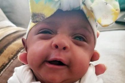 Nur so groß wie ein Apfel: Baby „Saybie“ in Kalifornien wog nur 245 Gramm