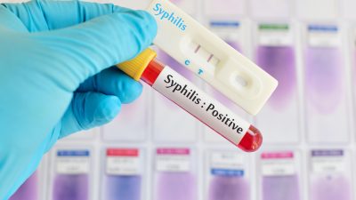 Syphilis-Fälle in Deutschland steigen sprunghaft an – vor allem in Berlin und Hamburg