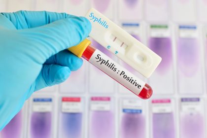 Zahl von Syphilisfällen in Deutschland erneut gestiegen