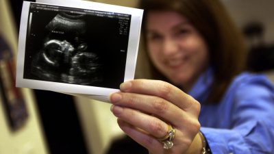 Unglaubliches Ultraschallbild: „Harfen-Engel“ wacht über ungeborenes Baby im Mutterleib