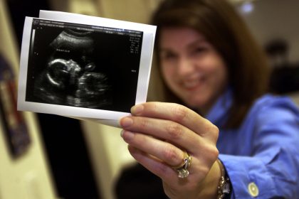 Unglaubliches Ultraschallbild: “Harfen-Engel” wacht über ungeborenes Baby im Mutterleib