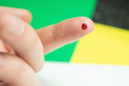 Aus Scham und Angst: 30.000 Menschen machen HIV-Selbsttests in Deutschland