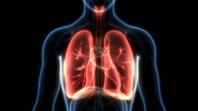 Lungen-CT: Video zeigt starke Lungenschäden bei Covid-19 Patient