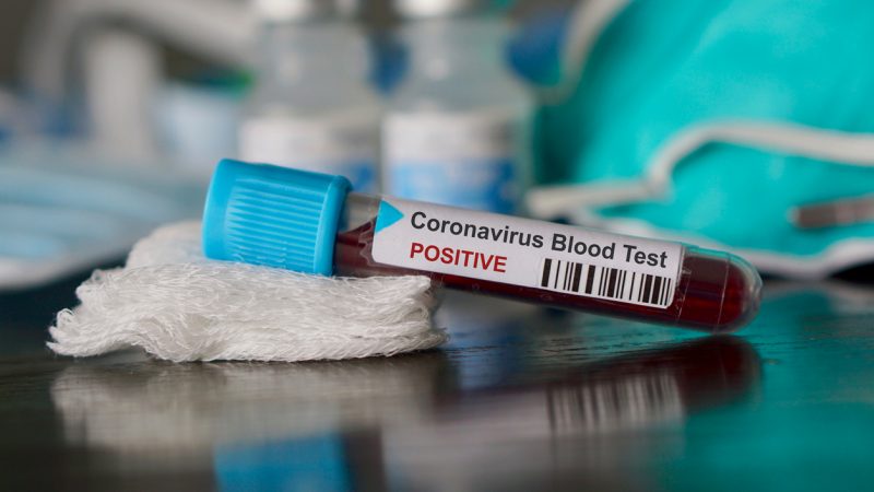 Erstmals Deutscher am neuartigen Coronavirus gestorben