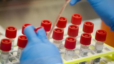 Bericht: Antikörper-Studie soll Immunität gegen Covid-19 feststellen