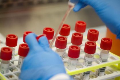 USA: Klinischer Test für Coronavirus-Impfstoff gestartet