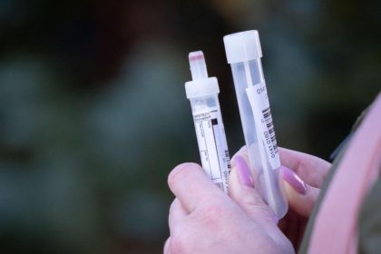 Wie aufschlussreich sind Antikörpertests wirklich?