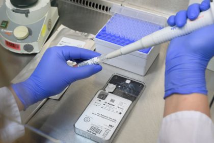 RKI-Studie startet in Baden-Württemberg: 2000 Teilnehmer unterziehen sich freiwillig Corona-Tests