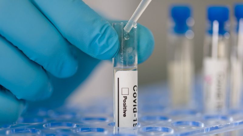 Studie: COVID-19-Antikörper im Blut nur von kurzer Dauer
