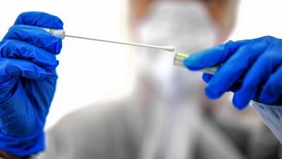 Mikrobiologe gegen Immunitätsausweis: „Wir wissen nicht, ob der Mensch, der Antikörper hat, wirklich geschützt ist“