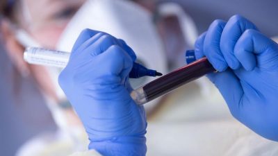 Studie: Corona-Antikörper in weniger als einem Prozent der Hamburger Blutspenden