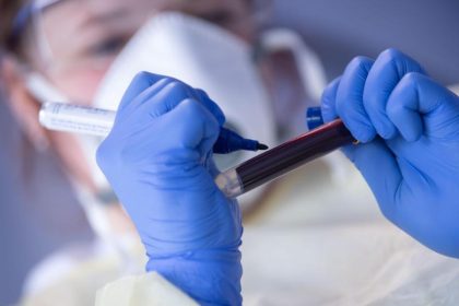 Studie: Corona-Antikörper in weniger als einem Prozent der Hamburger Blutspenden
