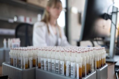 Tagesaktuelle Corona-Fallzahlen: 583 Neuinfektionen in Deutschland