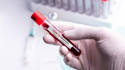 Frankreich: Patienten mit Fieber warten bis zu zwei Wochen auf Corona-Test