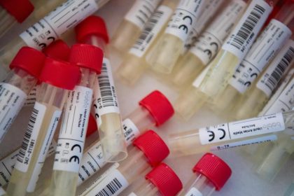 „Wir müssen im Herbst wirklich umdenken“: Virologin für sofortige Isolierung aller Kontaktpersonen