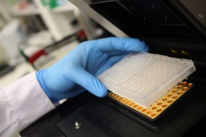 Bonner Forscher untersuchen Reaktion von Immunsystem auf Corona