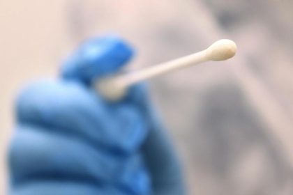 Corona-Test aus China führte in Schweden zu Tausenden falschen positiven Ergebnissen