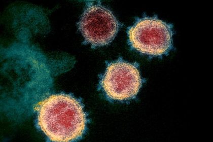 Amnesty spricht von „Skandal“: Weltweit 7000 Mitarbeiter im Gesundheitswesen an Covid-19 gestorben
