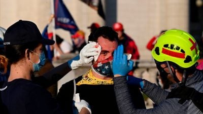 Million-MAGA-Marsch: Trump-Unterstützer angegriffen und in den Kopf geschnitten