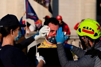 Million-MAGA-Marsch: Trump-Unterstützer angegriffen und in den Kopf geschnitten
