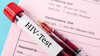 Zahl der HIV-Neuinfektionen 2019 leicht gestiegen