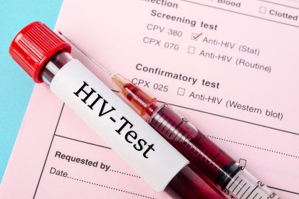 Zahl der HIV-Neuinfektionen 2019 leicht gestiegen