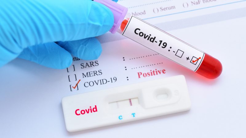 Corona-Einmaleins (I) – Fallzahlen: Erkrankt? Infiziert? Jeder positiv Getestete zählt als COVID-19 Fall