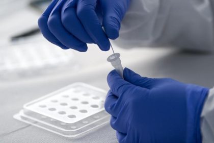 Unternehmen und Verbände befürworten Schnelltests – fordern aber rasche Klärung der Rechtsfragen