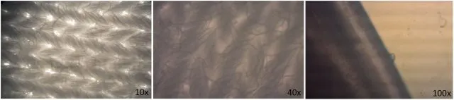 Rote &quot;Morgellonen&quot; oder Textilfasern?