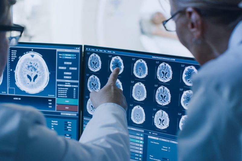 Corona-Patienten haben höheres Risiko einer neurologischen oder psychischen Erkrankung