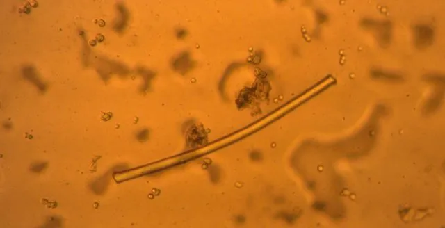 Eine isolierte „normale Faser“ in 50 µl Speichel.