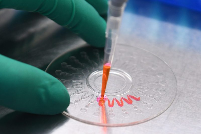 Laborthese „zu umständlich“: Charité-Virologe Drosten glaubt nicht an Virus aus Labor