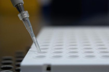 US-Seuchenschutzbehörde zieht Notfallzulassung für PCR-Tests zurück