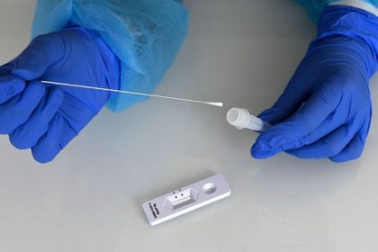 Beschlussentwurf: Bund und Länder planen Ende kostenloser Schnelltests im Oktober