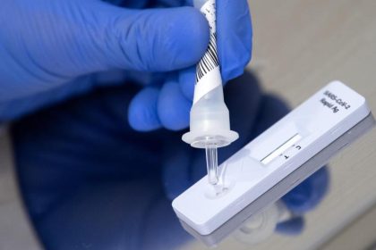 Aus für gratis Corona-Schnelltests – Wer ab Oktober fürs Testen zahlen muss