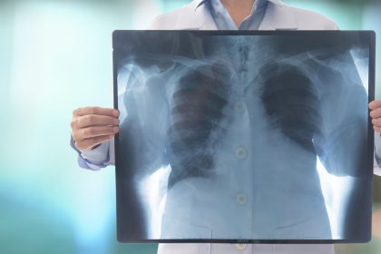 Studie weist hochwirksame Immunabwehr durch körpereigene Zellen im Gewebe nach