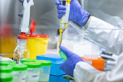 Labore kommen an ihre Grenzen – PCR-Tests sparsam verwenden