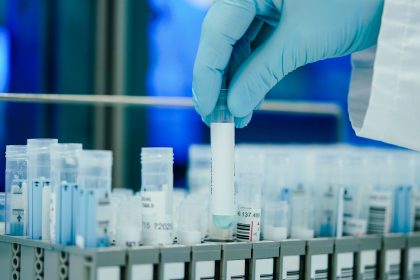 Kein PCR-Test mehr für alle – Novavax-Impfstoff zuerst für Gesundheitspersonal