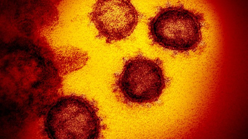 Ein von einem Patienten in den USA isoliertes Coronavirus SARS-CoV-2.