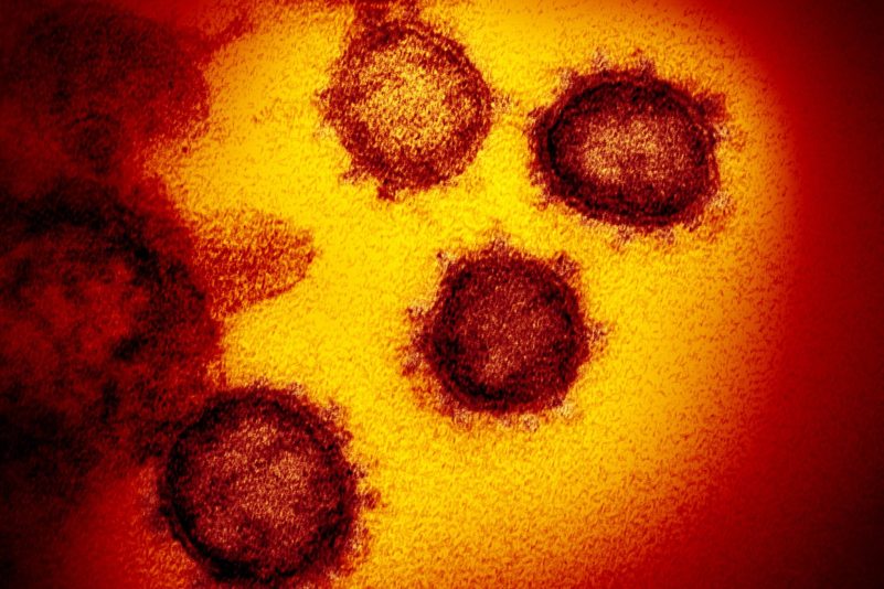 Ein von einem Patienten in den USA isoliertes Coronavirus SARS-CoV-2.