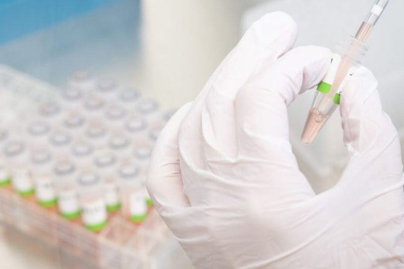 Im Labor wird ein PCR-Test auf das Coronavirus vorbereitet.